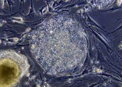 cellules souches